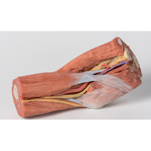Loketní jamka - svaly, velké nervy a pažní tepna