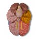 Oblastní model mozku - 5 částí