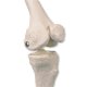 Mini model lidské kostry - s malovanými svaly - na závěsném stojanu